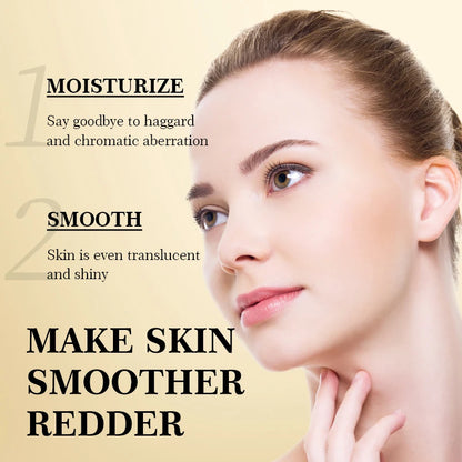 Vitamin C Improve Freckles Cream Fade Dark Spots Melasma Niacinamide Lightening Melanin Brighten Moisturizer Skin Care Products