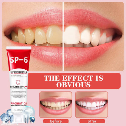 1/2/3Pcs SP6 Probiotics Whitening Toothpaste Enhanced Formula with 6 Probiotics for Teeth Whitening and Gum Health Deep Cleaning