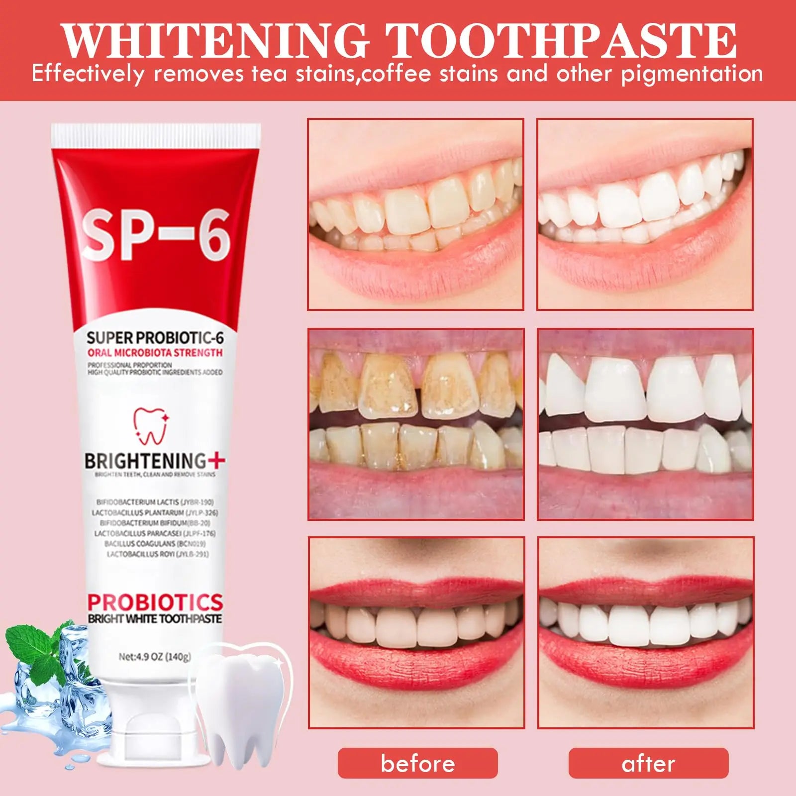 1/2/3Pcs SP6 Probiotics Whitening Toothpaste Enhanced Formula with 6 Probiotics for Teeth Whitening and Gum Health Deep Cleaning