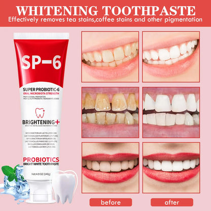 1/2/3Pcs SP6 Probiotics Whitening Toothpaste Enhanced Formula with 6 Probiotics for Teeth Whitening and Gum Health Deep Cleaning