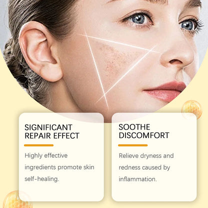 Bee Venom Skin Restoration Cream Skin Blemish Remover Reduce Redness Sensitive Skin Barrier Repair Skin Renewal Moisturizer 60g