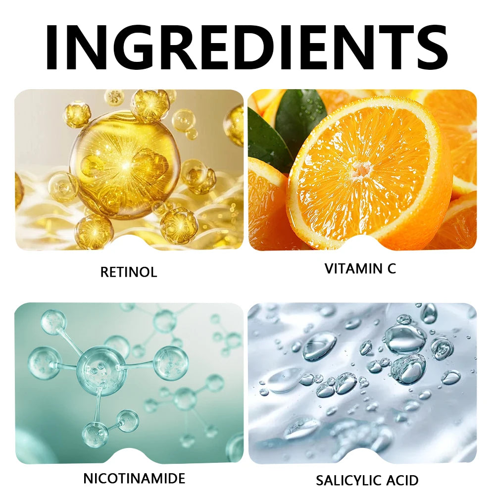 YOUNGCOME Vitamin C Serum For Face with Vitamin C, Hyaluronic Acid, Vitamin E – Brightening Formula – Improve  of Dark Spots