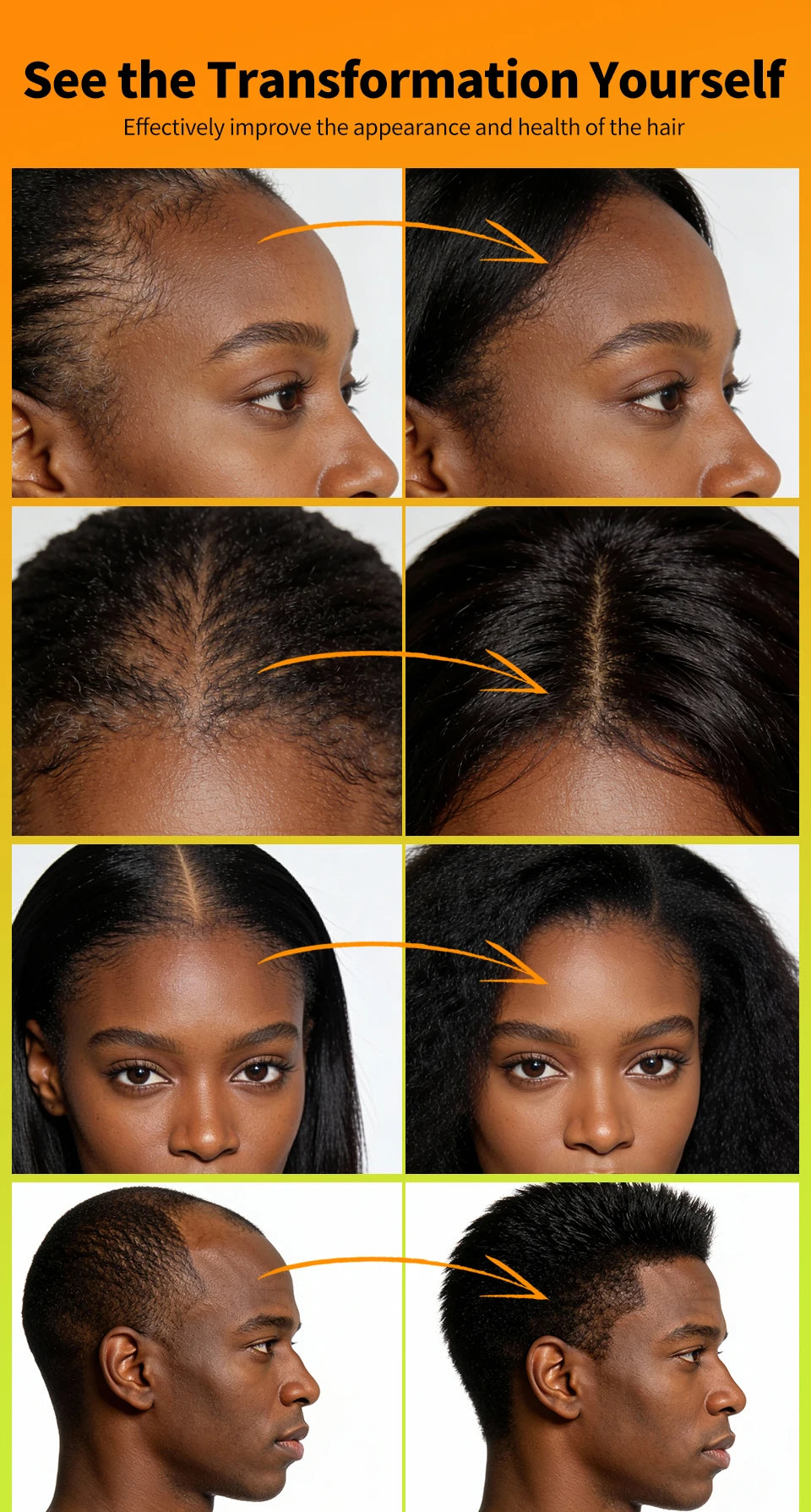Africa Chad Chebe Powder Nourishing Scalp Anti Hair Loss Hair Powder Strengthens &amp; Thickens Hair Care Product For All Hair Types