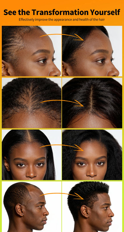 Africa Chad Chebe Powder Nourishing Scalp Anti Hair Loss Hair Powder Strengthens &amp; Thickens Hair Care Product For All Hair Types